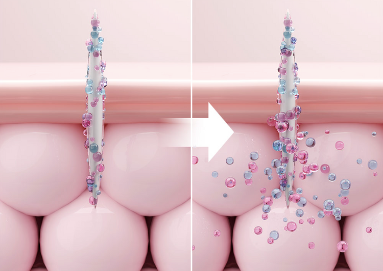 MICRO SPICULE